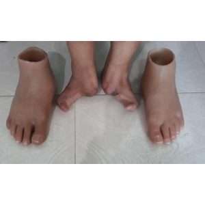 Silicone Cosmetic Foot For Partial Foot Amputation – Code: EME – 192
