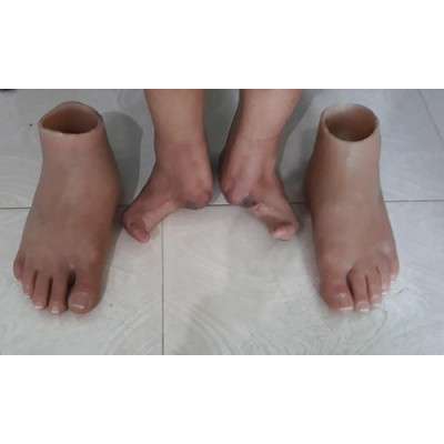 Silicone Cosmetic Foot For Partial Foot Amputation - Code: EME - 192 -  Edrees Medical