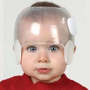 Transparent Cranial Molding Helmet – Code: EME – 160