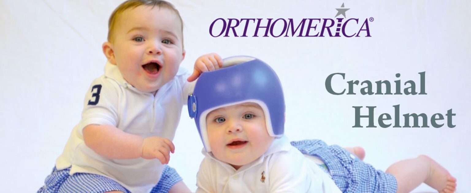 Custom Made & 3D Cranial Helmet In Dubai/UAE Edrees Medical
