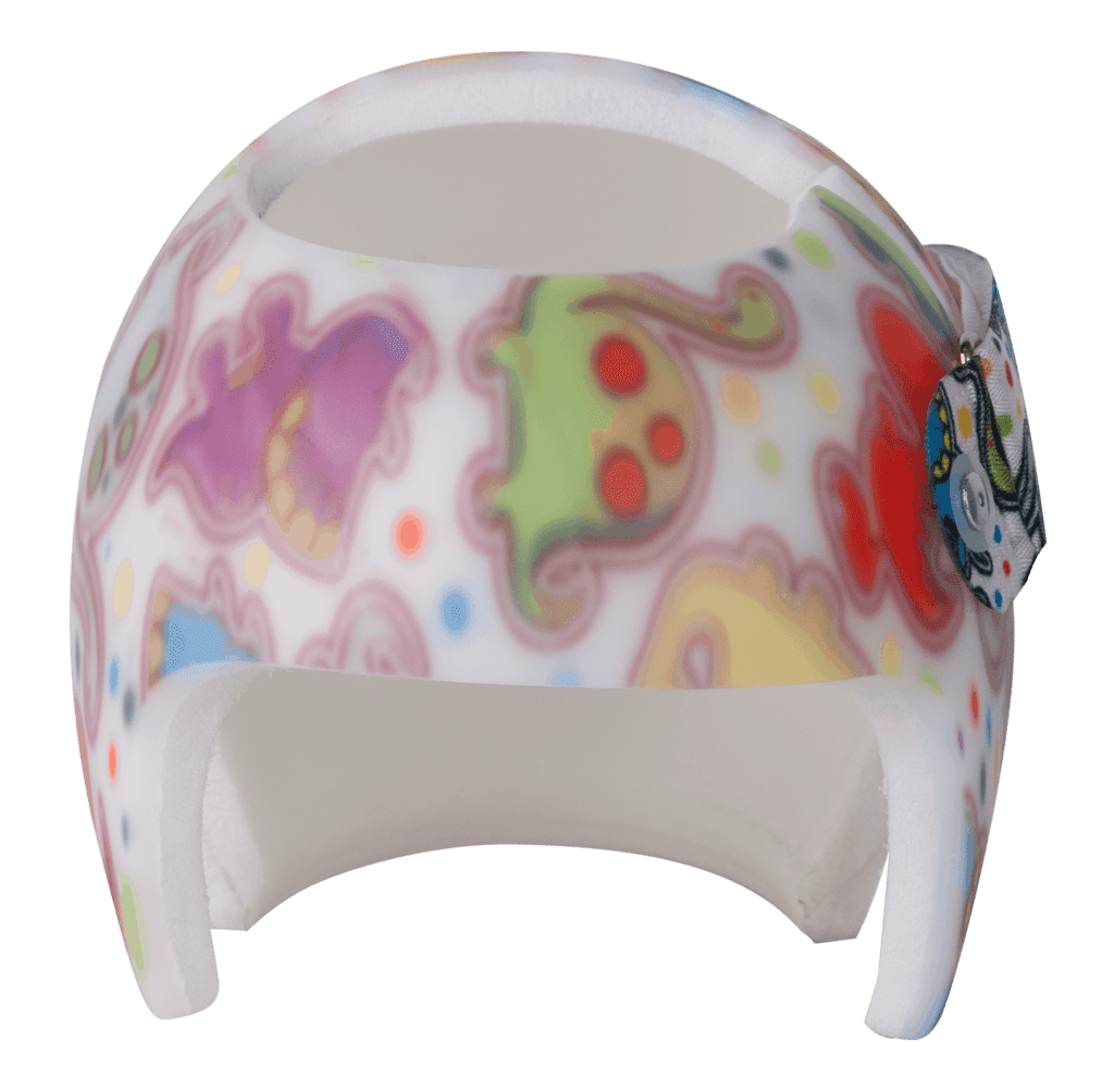 Custom Made & 3D Cranial Helmet In Dubai/UAE - Edrees Medical